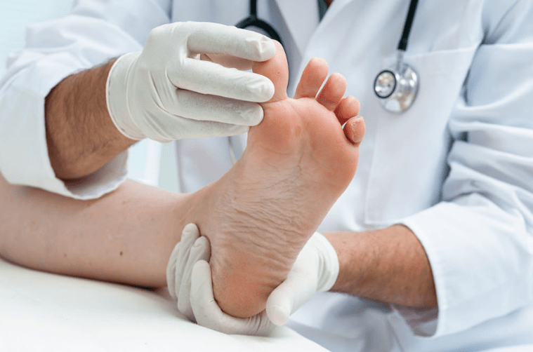 Nail fungus treatment