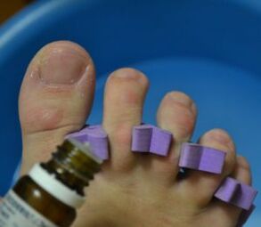 Preparing to treat nails with antifungal drops.