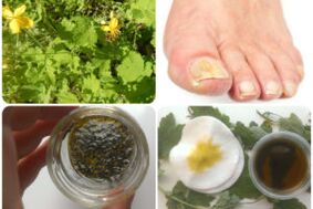 home remedies for toenail fungus